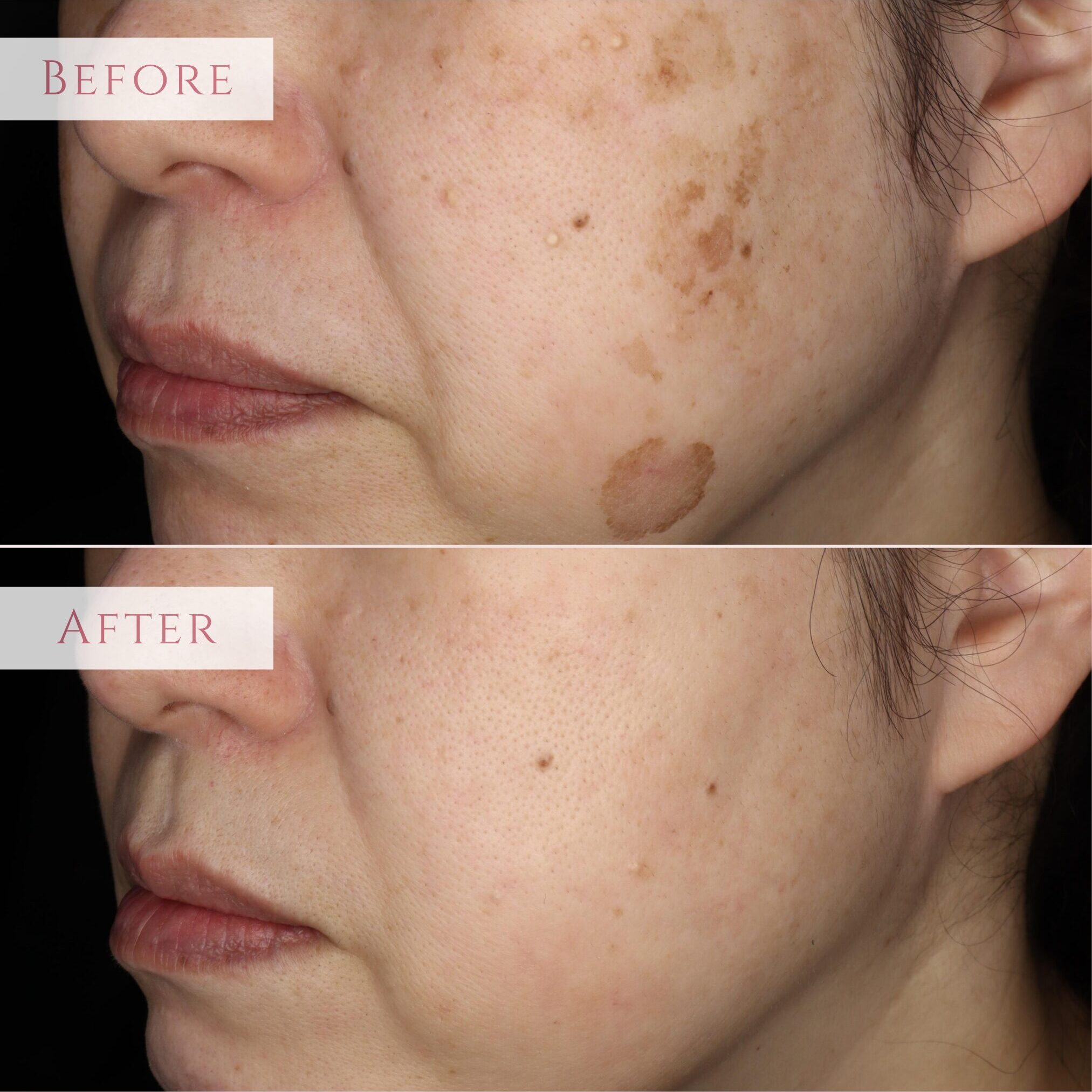 e93cb056cd4ff47bba0ac062a9e8c2