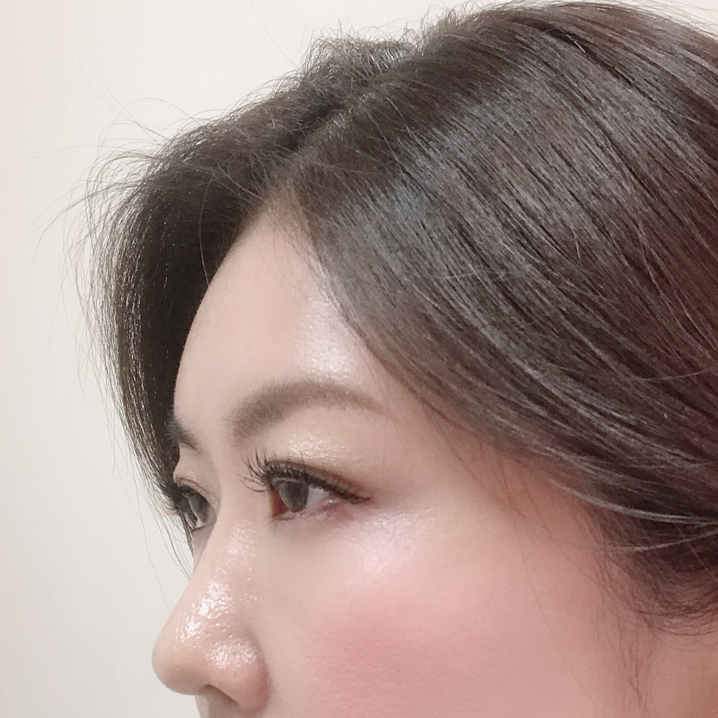 丸いおでこは七難隠す かもしれない 福岡市城南区の美容皮膚科 タケダスポーツ ビューティークリニック